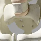 骨盤ケア